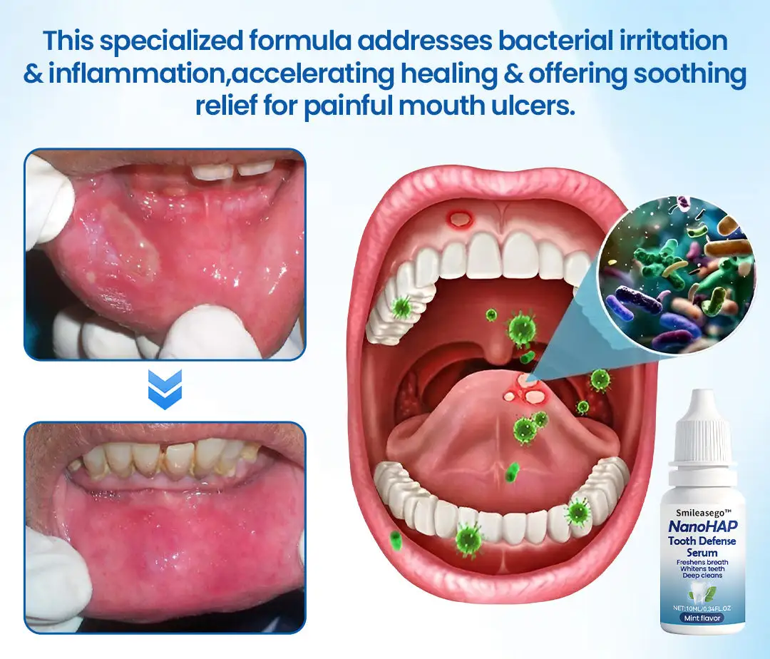 Smileasego™ NanoHAP Tooth Defense Serum