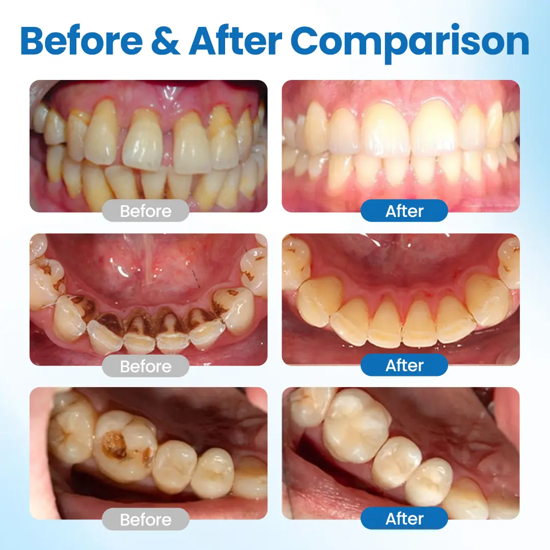 Smileasego™ NanoHAP Tooth Defense Serum