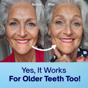 “This LOVILDS™ Teeth Whitening Powder keeps your smile bright for 6 MONTHS straight!！