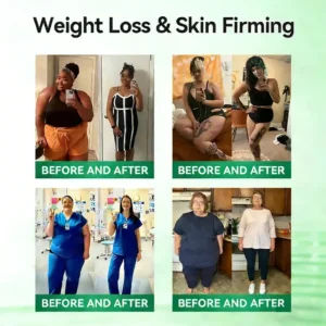 𝐎𝐟𝐟𝐢𝐜𝐢𝐚𝐥 𝐒𝐭𝐨𝐫𝐞 🇺🇸 |Blizkox™ Moringa·Berberine × NAD+ 10-in-1 Nano Microneedle Patch – Daily, Visible Results in 7 Days ✅ For Weight, Skin, Diabetes & Joint Health 🗽