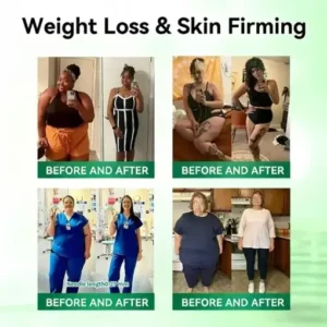 LOVILDS® 𝑴𝒐𝒓𝒊𝒏𝒈𝒂 𝑩𝒆𝒓𝒃𝒆𝒓𝒊𝒏𝒆 10-𝑰𝑵-1 𝑨𝒅𝒗𝒂𝒏𝒄𝒆𝒅 𝑵𝒂𝒏𝒐 𝑴𝒊𝒄𝒓𝒐𝒏𝒆𝒆𝒅𝒍𝒆 𝑷𝒂𝒕𝒄𝒉 (𝐎𝐧𝐜𝐞 𝐃𝐚𝐢𝐥𝐲, 𝐯𝐢𝐬𝐢𝐛𝐥𝐞 𝐜𝐡𝐚𝐧𝐠𝐞𝐬 𝐢𝐧 𝟕 𝐝𝐚𝐲𝐬 𝐎𝐛𝐞𝐬𝐢𝐭𝐲, 𝐃𝐢𝐚𝐛𝐞𝐭𝐞𝐬, 𝐒𝐥𝐞𝐞𝐩 𝐀𝐩𝐧𝐞𝐚, 𝐀𝐧𝐝 𝐉𝐨𝐢𝐧𝐭 𝐈𝐬𝐬𝐮𝐞𝐬