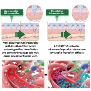 LOVILDS® 𝑴𝒐𝒓𝒊𝒏𝒈𝒂 𝑩𝒆𝒓𝒃𝒆𝒓𝒊𝒏𝒆 10-𝑰𝑵-1 𝑨𝒅𝒗𝒂𝒏𝒄𝒆𝒅 𝑵𝒂𝒏𝒐 𝑴𝒊𝒄𝒓𝒐𝒏𝒆𝒆𝒅𝒍𝒆 𝑷𝒂𝒕𝒄𝒉 (𝐎𝐧𝐜𝐞 𝐃𝐚𝐢𝐥𝐲, 𝐯𝐢𝐬𝐢𝐛𝐥𝐞 𝐜𝐡𝐚𝐧𝐠𝐞𝐬 𝐢𝐧 𝟕 𝐝𝐚𝐲𝐬 𝐎𝐛𝐞𝐬𝐢𝐭𝐲, 𝐃𝐢𝐚𝐛𝐞𝐭𝐞𝐬, 𝐒𝐥𝐞𝐞𝐩 𝐀𝐩𝐧𝐞𝐚, 𝐀𝐧𝐝 𝐉𝐨𝐢𝐧𝐭 𝐈𝐬𝐬𝐮𝐞𝐬