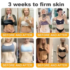 LOVILDS™ 🐝 Bee Venom Skin Restoration Cream 🐝