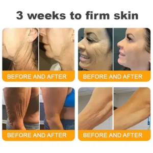 LOVILDS™ 🐝 Bee Venom Skin Restoration Cream 🐝