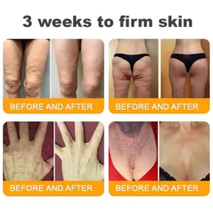 LOVILDS™ 🐝 Bee Venom Skin Restoration Cream 🐝