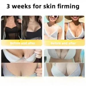 LOVILDS™ 🐝 Bee Venom Skin Restoration Cream 🐝