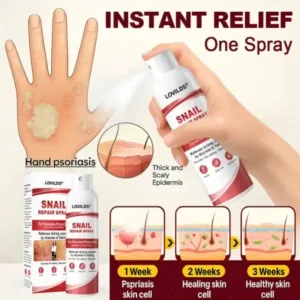 LOVILDS® Snail Repair Spray for Itchy, Flaky Psoriasis Skin