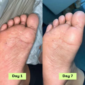 💫Limited-time offer: 💪55% off NESLEMY® AntiFungal Relief Soap Bar💫-----