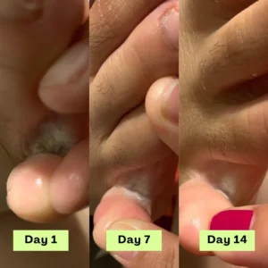 💫Limited-time offer: 💪55% off NESLEMY® AntiFungal Relief Soap Bar💫-----