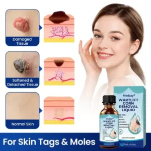 Medazy® WartLift Corn Removal Liquid