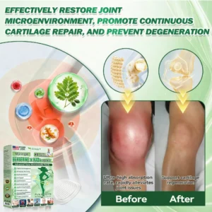 Slimoly™ Moringa & Berberine 10-IN-1 Advanced Nano Microneedle Patch(Once Daily, visible changes in 7 days) ✅ Obesity, Diabetes, Sleep Apnea, And Joint Issues